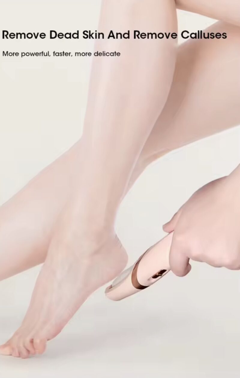 Electric Foot Callus Remover - Image 5